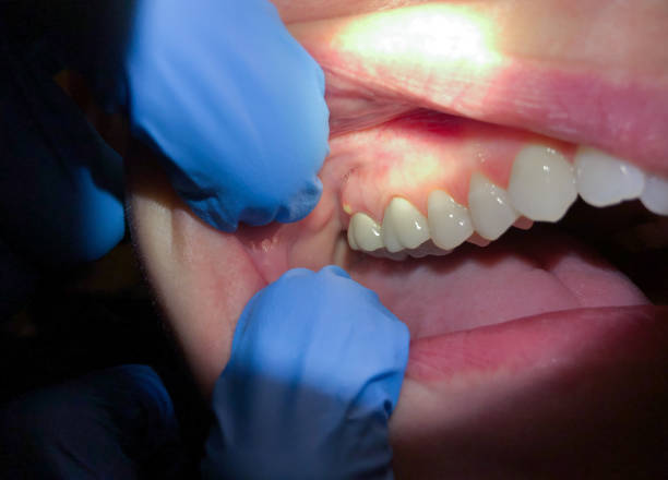 Best Weekend Emergency Dentist in Old Jefferson, LA