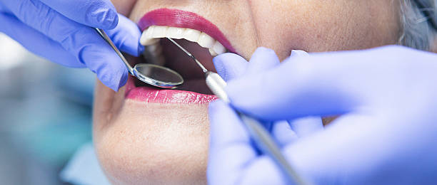 Best Emergency Dental Care for Broken or Chipped Teeth in Old Jefferson, LA